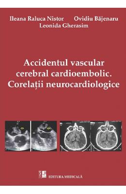 Accidentul vascular cerebral cardioembolic. Corelatii Neurocardiologice - Ileana Raluca Nistor