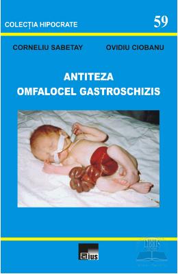 Antiteza omfalocel gastroschizis - Corneliu Sabetay, Ovidiu Ciobanu 1 Antiteza omfalocel gastroschizis - Corneliu Sabetay, Ovidiu Ciobanu